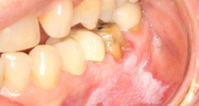 7 - Taller de Implementación de Estrategia de Examen de Medicina Preventivo (EMP) en Mucosa Oral.